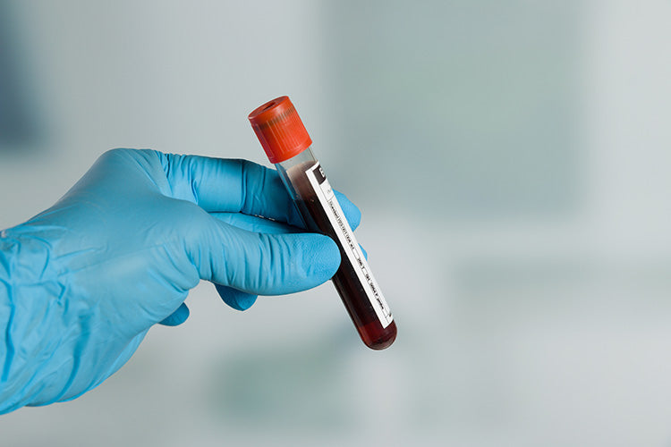 Microplastics found in human blood for the 1st time, study says